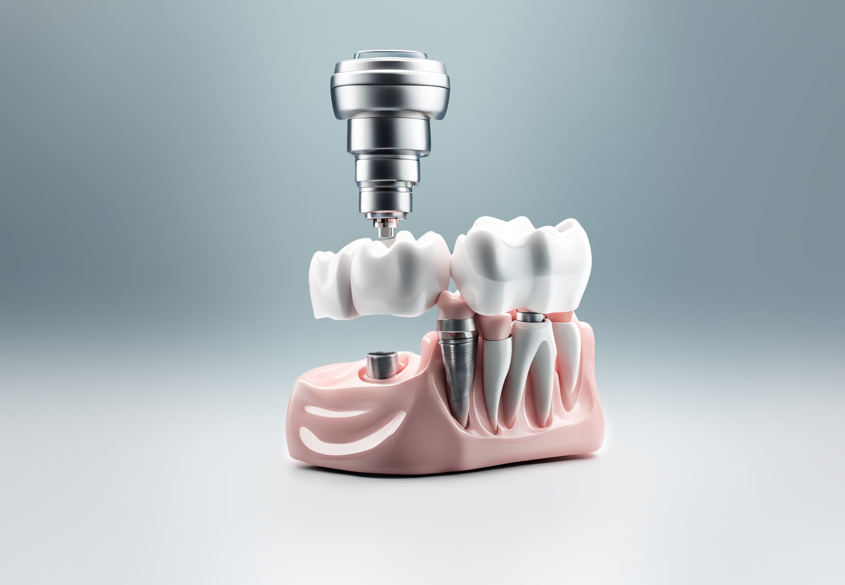 Zahnarztpraxis freudent – Oralchirurgie